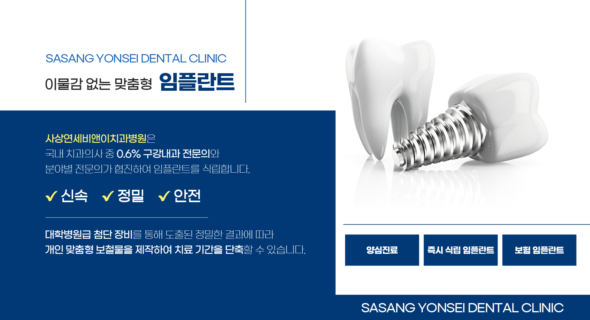 이물감 없는 맞춤형 임플란트